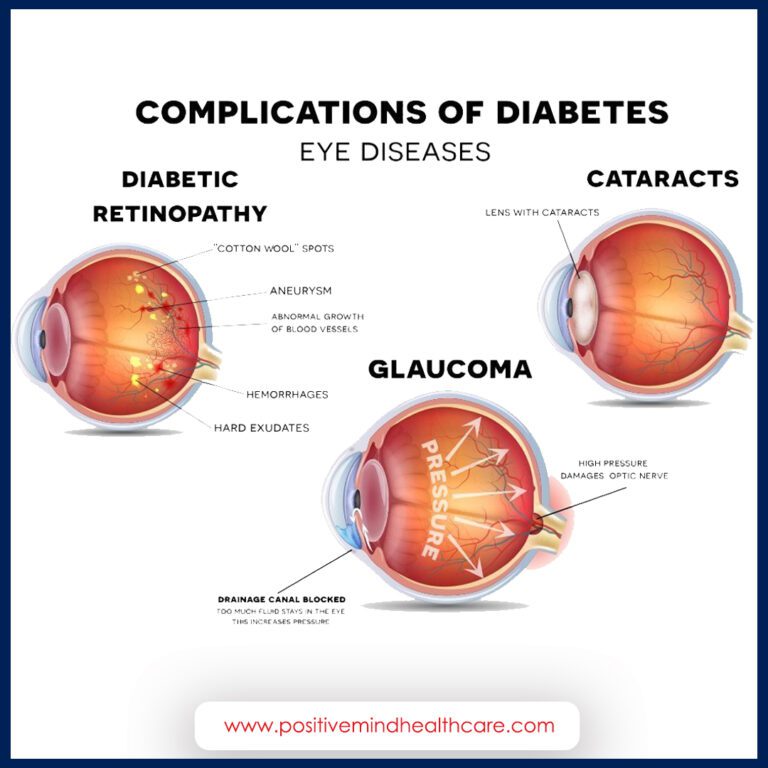Effects Of Diabetes On Vision