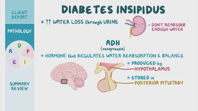 Diabetes insipidus