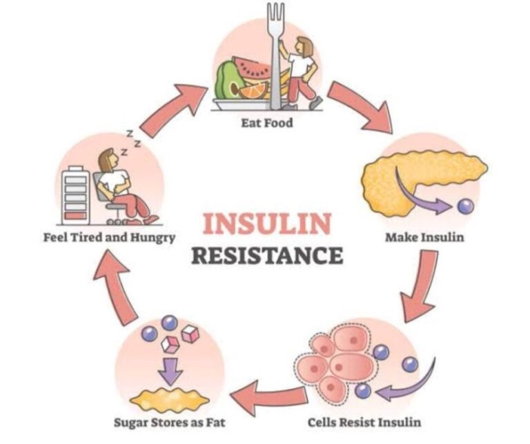 Side  Effects  of  Insulin Therapy