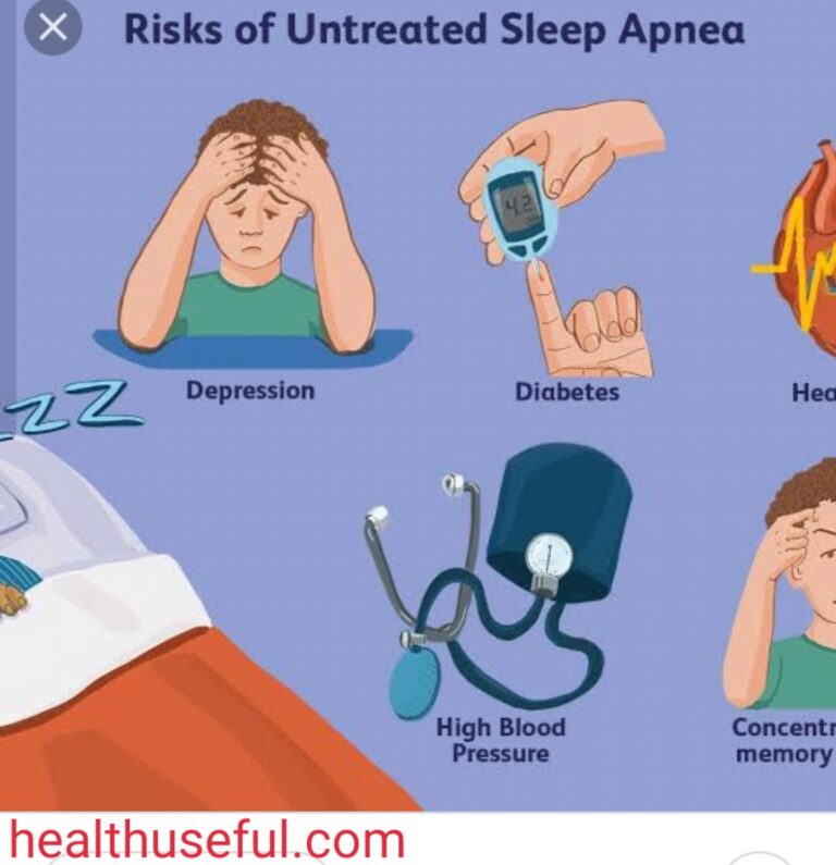 Sleep apnoea – Symtoms and Causes – Dr.Sagar