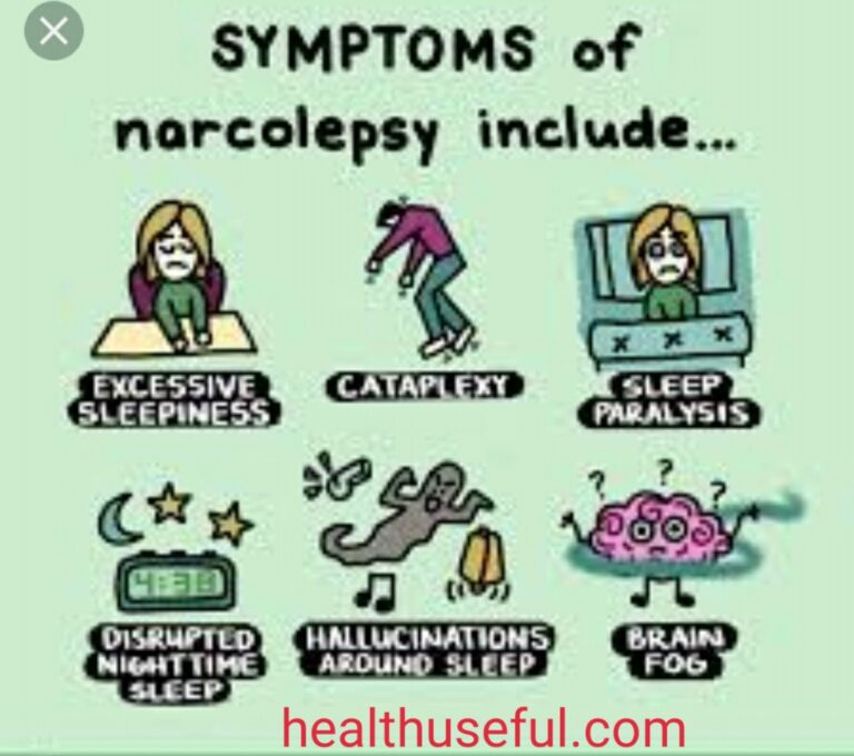 What is Narcolepsy?