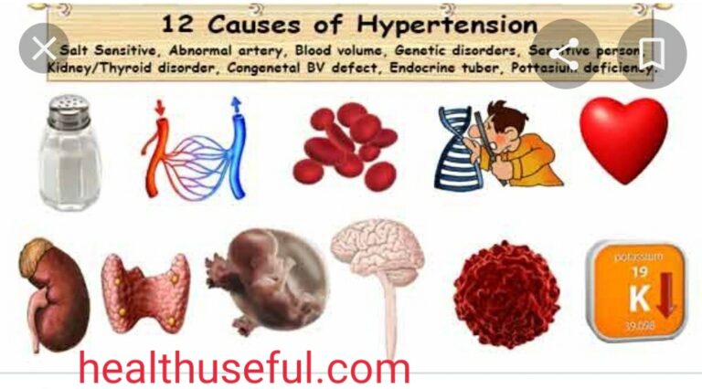 Eitiology of Hypertension