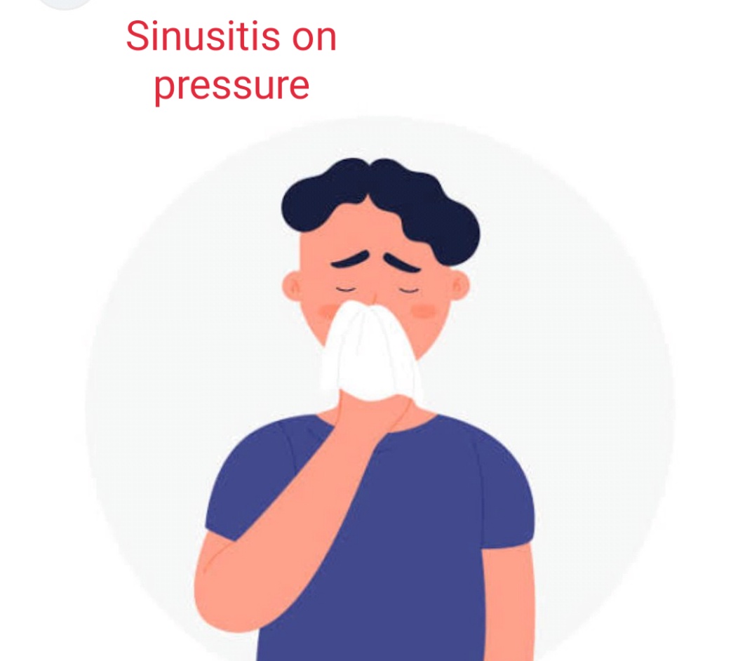 sinusitis-on-pressure