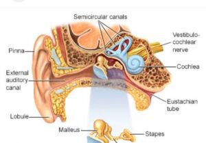 Image of permanent hearing loss from sinus infection