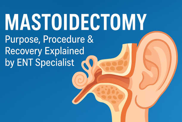 Mastoidectomy Surgery: Purpose, Procedure & Recovery Explained by ENT
