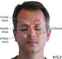 Image of Are sinus infections contagious to babies ?