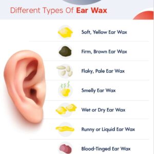 Image of Is Ear Wax Removal Painful