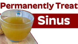 Image of how to cure sinus permanently