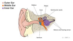 Image of Mastoid Surgery Aftercare