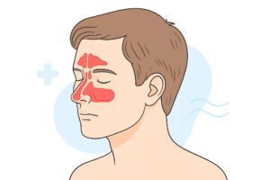 Can a Sinus Infection Cause Hair Loss?