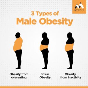 Image of Three Types of obesity are there