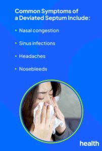 Image of deviated nasal septum symptoms