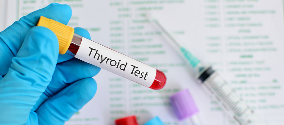 Is fasting required for thyroid test