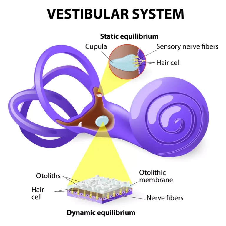 Vestibular neuritis treatment