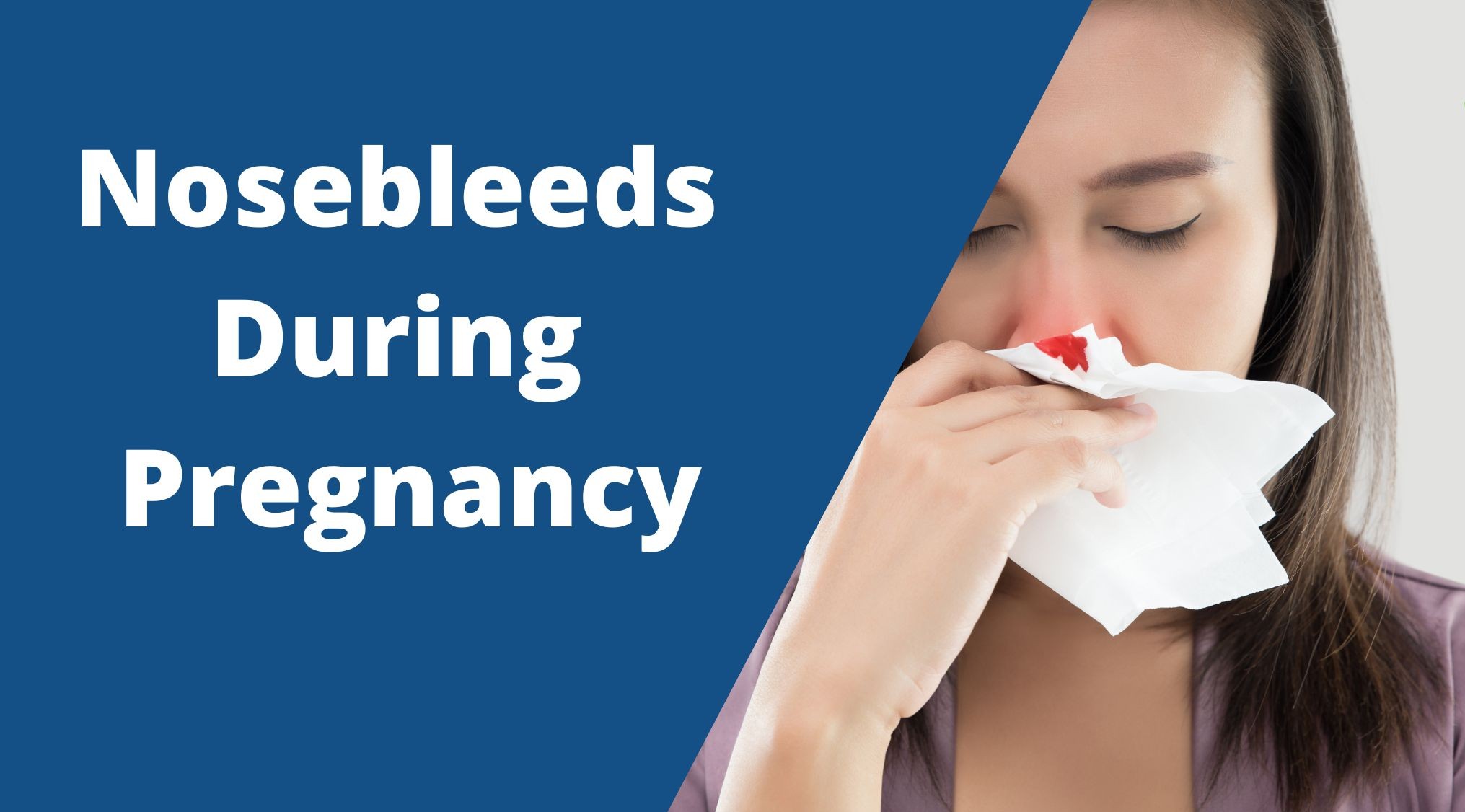 Nosebleeds-during-pregnancy.