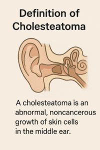 Definition of Cholesteatoma