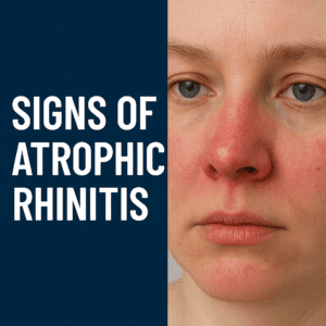 Signs of Atrophic Rhinitis