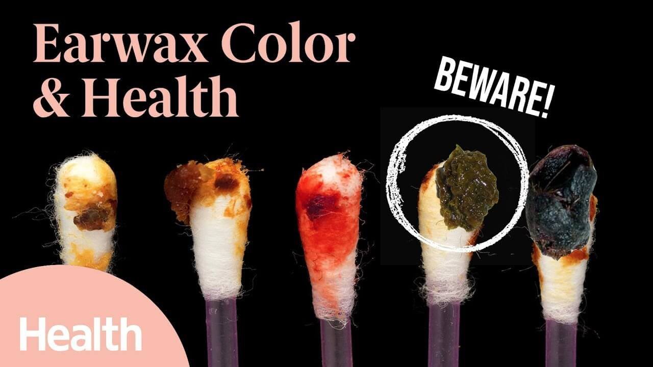 What Your Earwax Color Says About Your Health