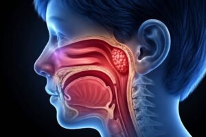 How Long Do Adenoids Take to Grow Back After Surgery?