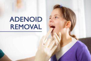 Image of Adenoidectomy (Adenoid Removal)
