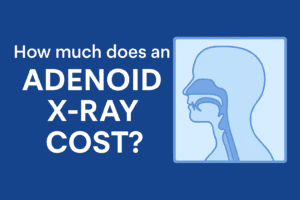 Image of How Much Does an Adenoid X-Ray Cost?