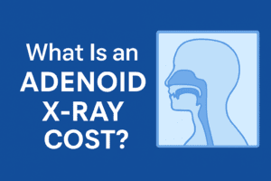 Image of What Is an Adenoid X-Ray?