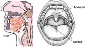Image of Adenoid