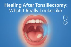 healing tonsillectomy