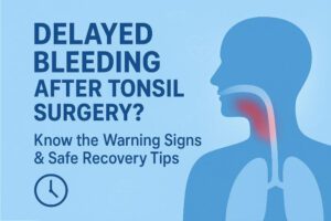 delayed hemorrhage after tonsillectomy