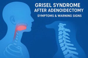 Grisel Syndrome after Adenoidectomy