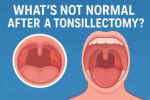 What’s Not Normal After a Tonsillectomy?