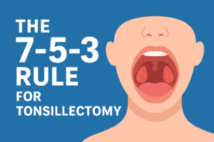 What Is The 7 5 3 Rule For Tonsillectomy