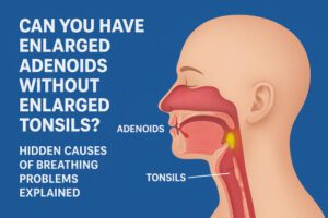 Image of Can you have enlarged adenoids without enlarged tonsils
