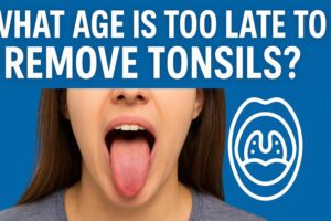 Image of What Age Is Too Late to Remove Tonsils?