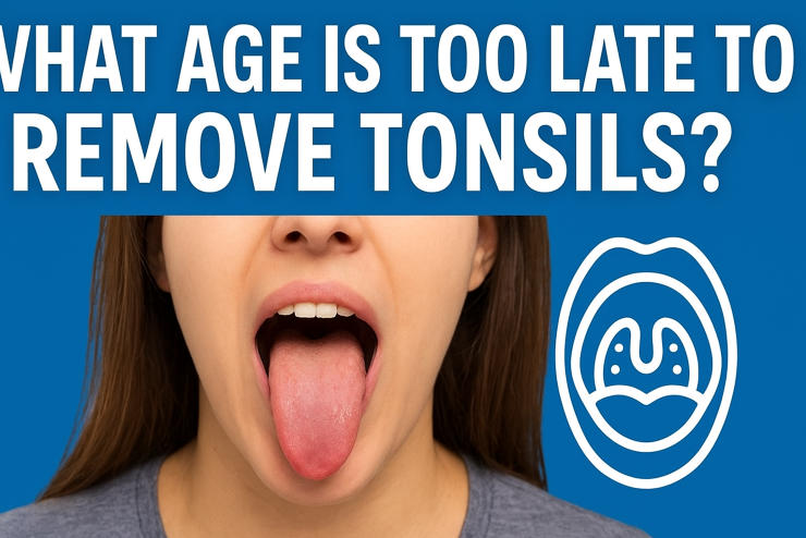 Image of What Age Is Too Late to Remove Tonsils?