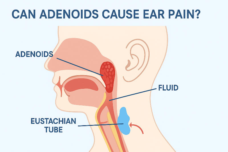 Image of Can Adenoids Cause Ear Pain?