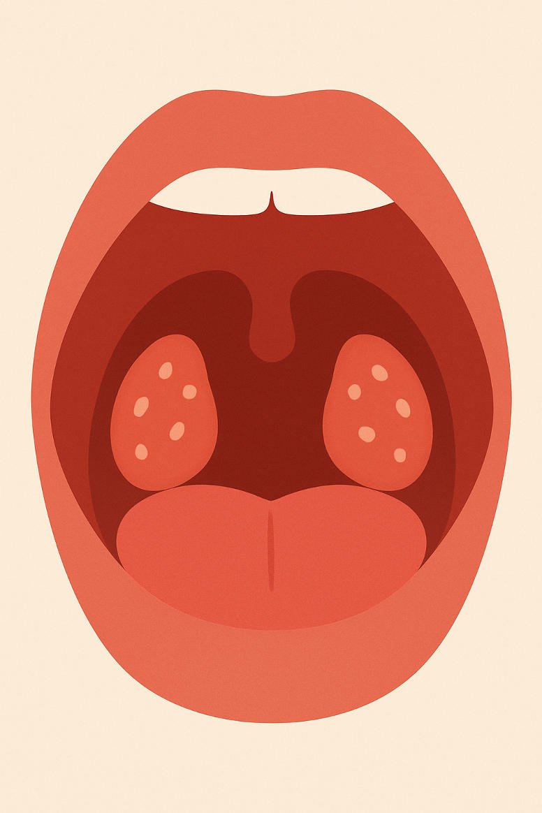 Image of Does Removing Tonsils Change Your Voice?