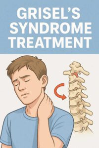 Grisel’s Syndrome Treatment
