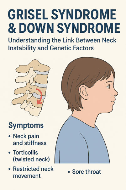 Grisel’s Syndrome in Down Syndrome