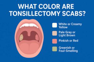 What Color Are Tonsillectomy Scabs?