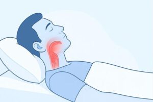 When Can I Sleep Flat After a Tonsillectomy?