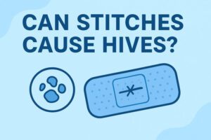 Can stitches cause hives?