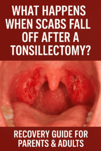What Happens When Scabs Fall Off After a Tonsillectomy