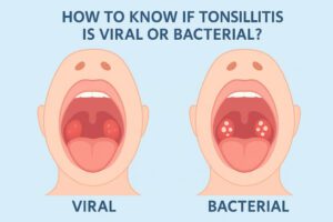 How to know if tonsillitis is viral or bacterial?