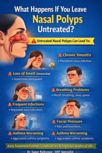 What Happens If Polyps Are Untreated? ENT Guide