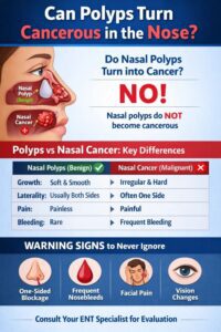 Can Nasal Polyps Turn Cancerous?