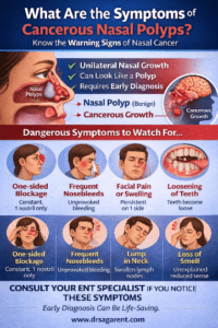 Symptoms of Cancerous Nasal Polyps: ENT Guide