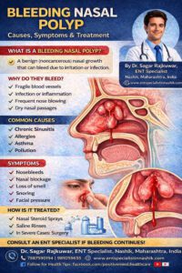 can polyps bleed in nose