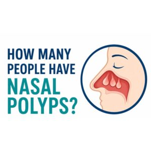 How Many People Have Nasal Polyps?