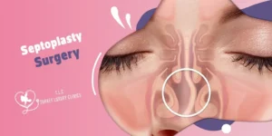 Is Septoplasty a Major or Minor Surgery?